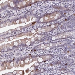 ABHD16B Antibody, Novus Biologicals 25 &mu;L, Unlabeled:Antibodies, Polyclonal